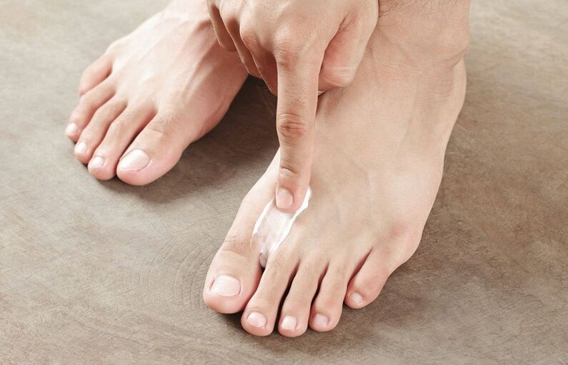 ointment for the treatment of toenail fungus