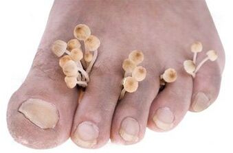 Fungi on the feet
