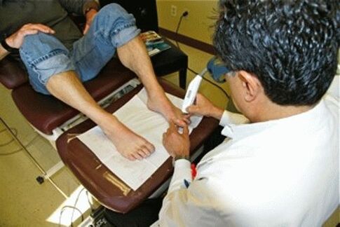 nail fungus removal with laser